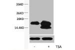 Western blot analysis of extracts from Hela cells, untreated (-) or treated, 1:5000.