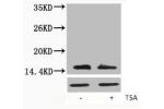 Western blot analysis of extracts from Hela cells, untreated (-) or treated, 1:5000.