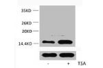 Western blot analysis of extracts from Hela cells, untreated (-) or treated, 1:5000.