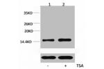 Western blot analysis of extracts from Hela cells, untreated (-) or treated, 1:5000.