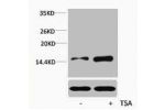 Western blot analysis of extracts from Hela cells, untreated (-) or treated, 1:5000.