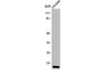 Western Blot analysis of HeLa cells using 4E-BP1 Polyclonal Antibody