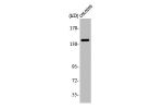 Western Blot analysis of COLO205 cells using A Cyclase V/VI Polyclonal Antibody