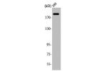Western Blot analysis of 293 cells using ABCA6 Polyclonal Antibody