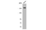 Western Blot analysis of HuvEc cells using ABCA8 Polyclonal Antibody