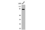 Western Blot analysis of HepG2 cells using ABCB7 Polyclonal Antibody