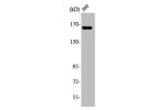 Western Blot analysis of HuvEc cells using ABCC12 Polyclonal Antibody