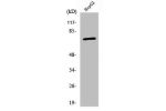 Western Blot analysis of HepG2 cells using ABCD4 Polyclonal Antibody