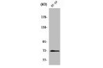 Western Blot analysis of HT29 cells using ABCG2 Polyclonal Antibody