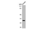 Western Blot analysis of HuvEc cells using ABHD11 Polyclonal Antibody