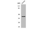 Western Blot analysis of COLO205 cells using ABHD6 Polyclonal Antibody