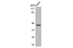 Western Blot analysis of A549 cells using ACAT-1 Polyclonal Antibody
