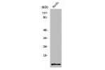 Western Blot analysis of HuvEc cells using ACBP Polyclonal Antibody