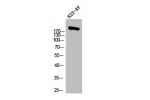 Western Blot analysis of 823-AV cells using ACCa Polyclonal Antibody