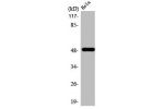 Western Blot analysis of A549 cells using AChRa10 Polyclonal Antibody