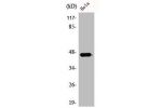 Western Blot analysis of COLO205 cells using ACOT4 Polyclonal Antibody