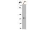 Western Blot analysis of HuvEc cells using ACOT8 Polyclonal Antibody