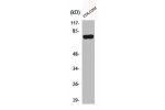 Western Blot analysis of Jurkat cells using ACSL6 Polyclonal Antibody