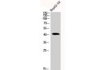 Western Blot analysis of HEPG2-UV cells using Actin a1 Polyclonal Antibody