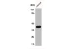 Western Blot analysis of COLO205 cells using Actin a3 Polyclonal Antibody