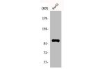 Western Blot analysis of HuvEc cells using Actinin-a2/3 Polyclonal Antibody