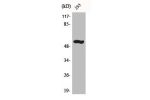 Western Blot analysis of mouse liver cells using ACTR-IB Polyclonal Antibody