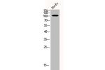 Western Blot analysis of HUVEC cells using ADAMTS-1 Polyclonal Antibody