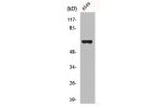 Western Blot analysis of RAW264.7 cells using ADCK1 Polyclonal Antibody