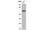 Western Blot analysis of HuvEc cells using ADCK5 Polyclonal Antibody