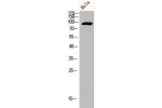 Western Blot analysis of HELA cells using Adducin a/