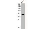 Western Blot analysis of MCF7 cells using Adenosine A3-R Polyclonal Antibody