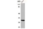 Western Blot analysis of HeLa cells using AI-BP Polyclonal Antibody