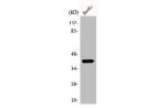 Western Blot analysis of HuvEc cells using AIM2 Polyclonal Antibody