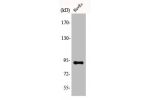 Western Blot analysis of COLO205 cells using AKAP 149 Polyclonal Antibody