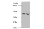 All lanes: Rho GDP-dissociation inhibitor 1 antibody at 2ug/ml<br />
Lane 1 : EC109 whole cell lysate<br />
Lane 2 : 293T whole cell lysate<br />
Secondary<br />
Goat polyclonal to Rabbit IgG at 1/15000 dilution<br />
Predicted band size: 24,19 kDa<br />
