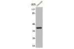 Western Blot analysis of HT29 cells using Aldolase A Polyclonal Antibody