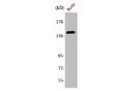 Western Blot analysis of HuvEc cells using Amyloid-