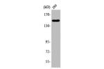 Western Blot analysis of COLO205 cells using ANKRD30A Polyclonal Antibody