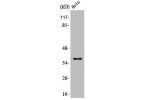 Western Blot analysis of HeLa cells using Annexin I Polyclonal Antibody