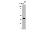 Western Blot analysis of COLO205 cells using Apaf-1-ALT Polyclonal Antibody