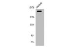 Western Blot analysis of COLO205 cells using APC Polyclonal Antibody