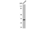 Western Blot analysis of COLO205 cells using APHC Polyclonal Antibody