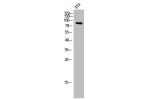 Western Blot analysis of 3T3 cells using APLP-2 Polyclonal Antibody