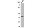 Western Blot analysis of COLO205 cells using ApoL2 Polyclonal Antibody