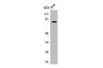 Western Blot analysis of A549 cells using APPL1 Polyclonal Antibody
