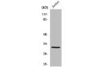 Western Blot analysis of Jurkat cells using AQP12 Polyclonal Antibody
