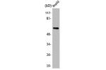 Western Blot analysis of HepG2 cells using AR a2C Polyclonal Antibody