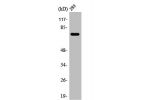 Western Blot analysis of Jurkat cells using ARHGAP18 Polyclonal Antibody