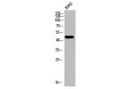 Western Blot analysis of K562 cells using Arp3 Polyclonal Antibody