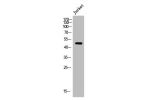 Western Blot analysis of Jurkat cells using Arrdc1 Polyclonal Antibody